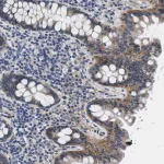 Merck Anti-SLC30A1 antibody produced in rabbit