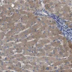 Merck Anti-SERPINA6 antibody produced in rabbit