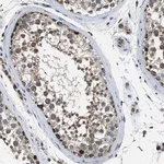 Merck Anti-STK33 antibody produced in rabbit