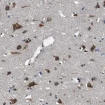 Merck Anti-TMED2 antibody produced in rabbit