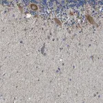 Merck Anti-CAMKK2 antibody produced in rabbit