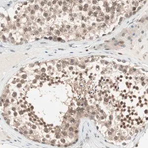 Merck Anti-UBE2I antibody produced in rabbit