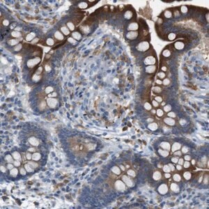 Merck Anti-MOGAT3 antibody produced in rabbit