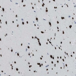 Merck Anti-TTC13 antibody produced in rabbit