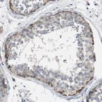 Merck Anti-BNC2 antibody produced in rabbit