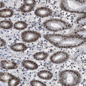 Merck Anti-MAPKAPK5 antibody produced in rabbit