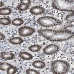 Merck Anti-MAPKAPK5 antibody produced in rabbit