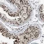 Merck Anti-KPNA6 antibody produced in rabbit