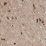 Merck Anti-GPR61 antibody produced in rabbit