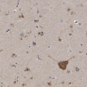 Merck Anti-FAM69A antibody produced in rabbit