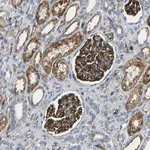 Merck Anti-IGSF10 antibody produced in rabbit