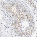 Merck Anti-OPRM1 antibody produced in rabbit