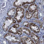 Merck Anti-SNX19 antibody produced in rabbit