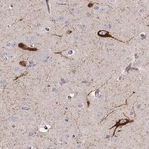 Merck Anti-TAC1 antibody produced in rabbit