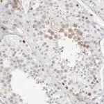 Merck Anti-AURKA antibody produced in rabbit