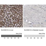 Merck Anti-SLC25A13 antibody produced in rabbit