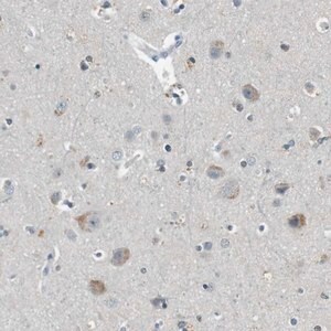 Merck Anti-CDK14 antibody produced in rabbit