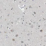 Merck Anti-CDK14 antibody produced in rabbit