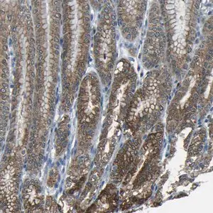 Merck Anti-ANKRD22 antibody produced in rabbit