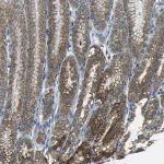 Merck Anti-ANKRD22 antibody produced in rabbit