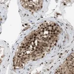 Merck Anti-ORAI3 antibody produced in rabbit