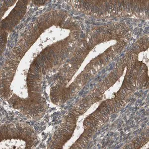 Merck Anti-CTPS2 antibody produced in rabbit