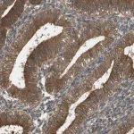 Merck Anti-CTPS2 antibody produced in rabbit