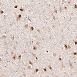 Merck Anti-PSMD14 antibody produced in rabbit