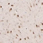 Merck Anti-PSMD14 antibody produced in rabbit