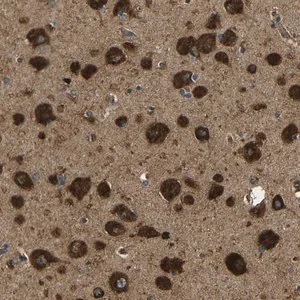 Merck Anti-ATP7A antibody produced in rabbit