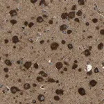 Merck Anti-ATP7A antibody produced in rabbit