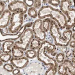 Merck Anti-ENPP4 antibody produced in rabbit