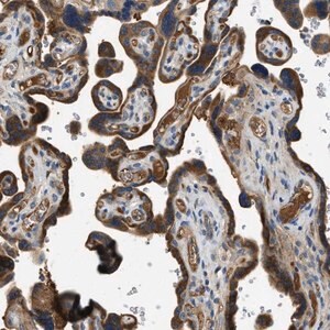 Merck Anti-RIPK2 antibody produced in rabbit