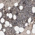 Merck Anti-GPATCH2L antibody produced in rabbit