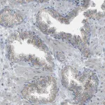 Merck Anti-ZNF516 antibody produced in rabbit