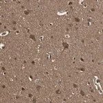 Merck Anti-YWHAE antibody produced in rabbit