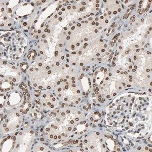 Merck Anti-RPS6KA3 antibody produced in rabbit