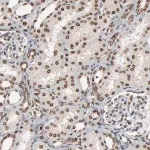 Merck Anti-RPS6KA3 antibody produced in rabbit