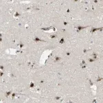 Merck Anti-KDM7A antibody produced in rabbit