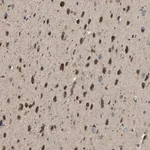 Merck Anti-SEC62 antibody produced in rabbit