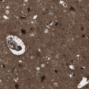 Merck Anti-SLITRK5 antibody produced in rabbit