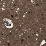 Merck Anti-SLITRK5 antibody produced in rabbit