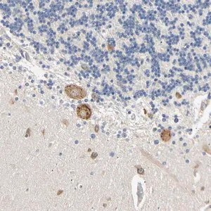 Merck Anti-RARS antibody produced in rabbit