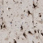 Merck Anti-TSPAN3 antibody produced in rabbit