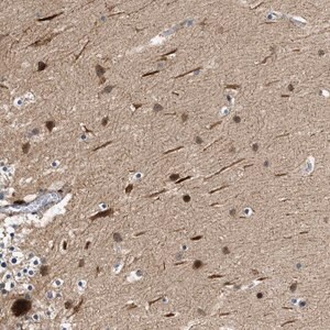 Merck Anti-ZNF599 antibody produced in rabbit