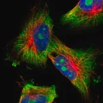 Merck Anti-KCNC4 antibody produced in rabbit