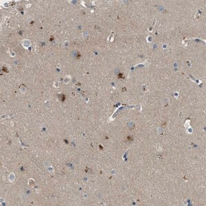 Merck Anti-MAN2A2 antibody produced in rabbit