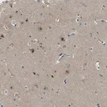 Merck Anti-MAN2A2 antibody produced in rabbit