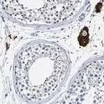 Merck Anti-VMA21 antibody produced in rabbit