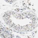 Merck Anti-ENTPD4 antibody produced in rabbit